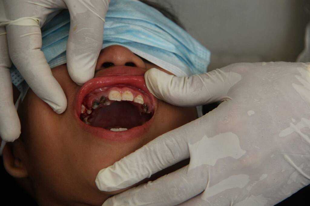 patient going through dental implant