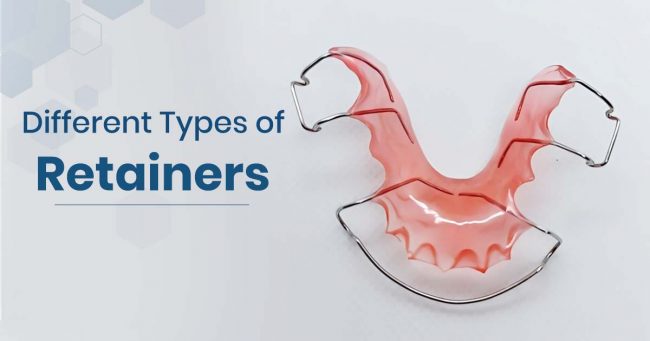 types of retainers